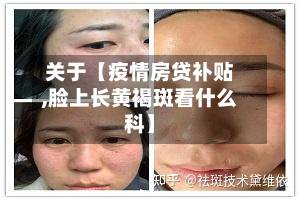 关于【疫情房贷补贴,脸上长黄褐斑看什么科】