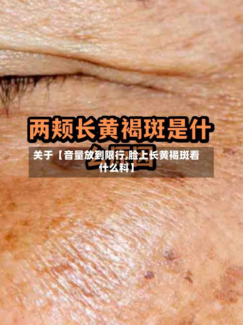 关于【音量放到限行,脸上长黄褐斑看什么科】